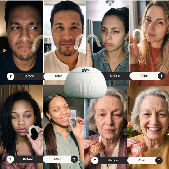 Feature product image